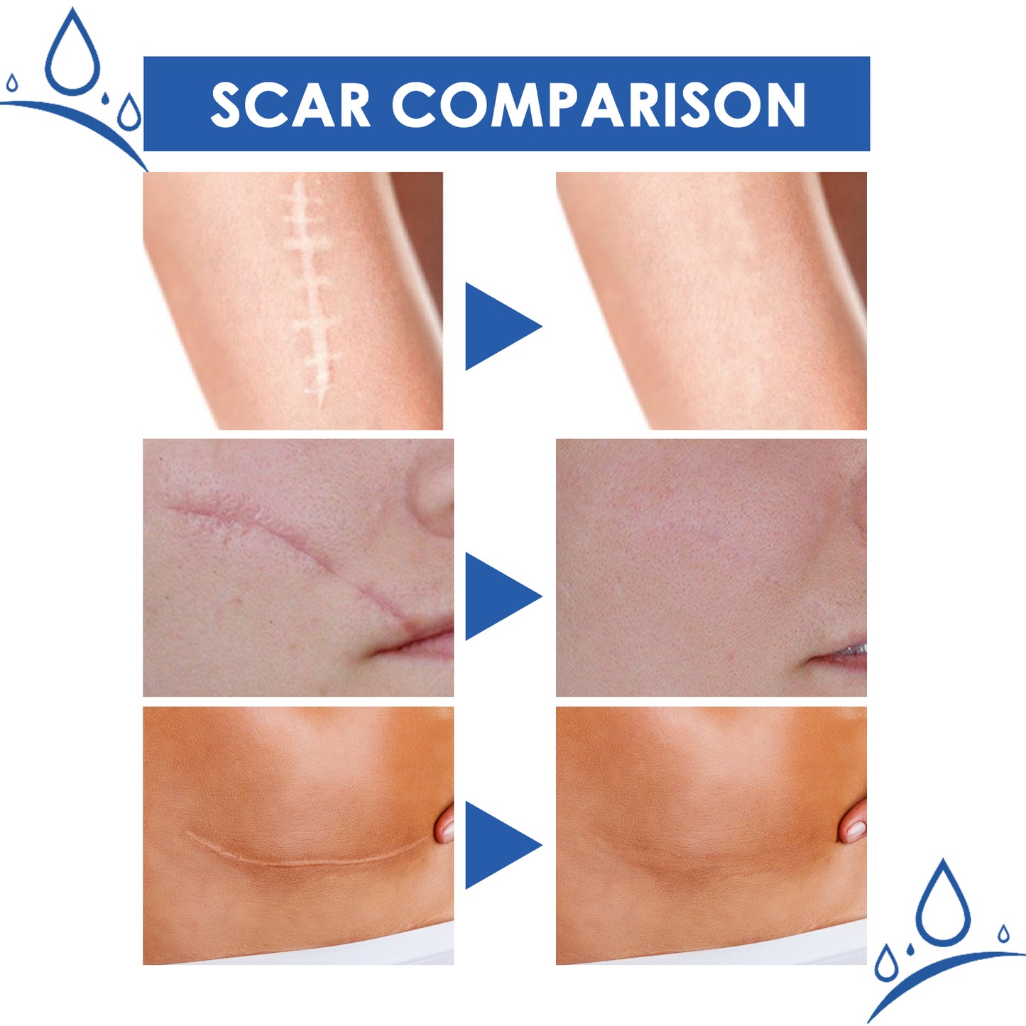 ..Jaysuing Scar Cream, Fade Scars Smooth And Firming Skin Repair Cream