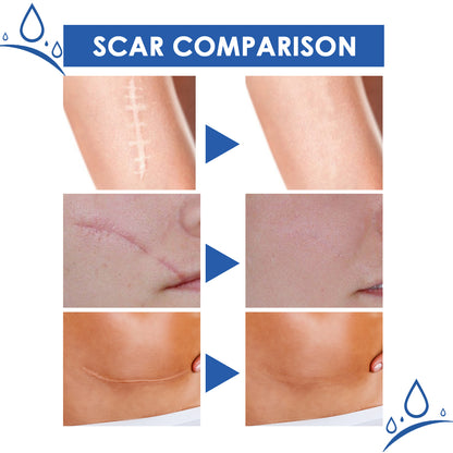 ..Jaysuing Scar Cream, Fade Scars Smooth And Firming Skin Repair Cream
