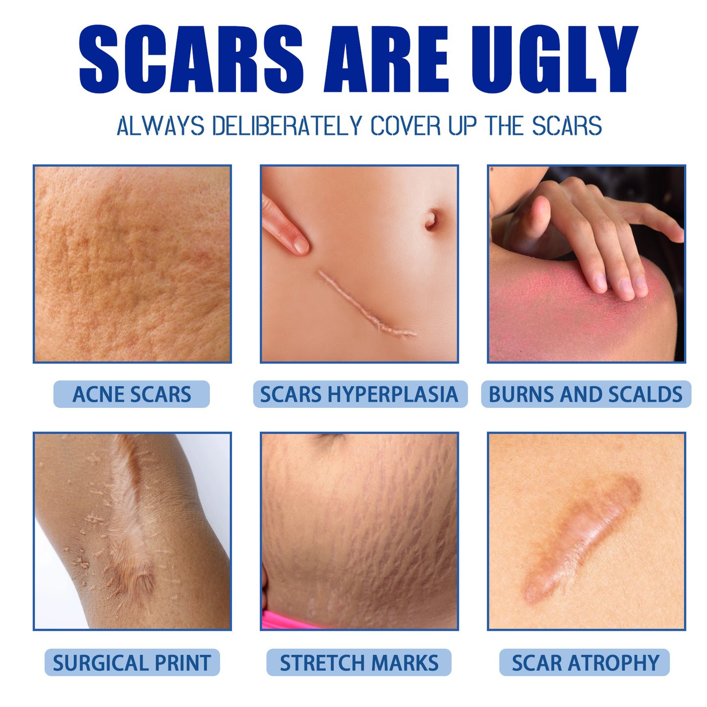 ..Jaysuing Scar Cream, Fade Scars Smooth And Firming Skin Repair Cream
